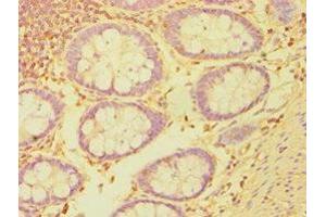 Immunohistochemistry of paraffin-embedded human colon tissue using ABIN7149358 at dilution of 1:100