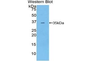 Detection of Recombinant PDK4, Mouse using Polyclonal Antibody to Pyruvate Dehydrogenase Kinase 4 (PDK4) (PDK4 anticorps  (AA 117-387))