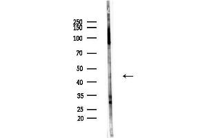 Western blot analysis of lysates from LoVo cells(heat-shock,45 min treatment), using C Antibody at 1/1000 dilution.