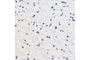 Immunohistochemistry of paraffin-embedded Rat brain using GTF3C3 Rabbit pAb (ABIN7267374) at dilution of 1:100 (40x lens).