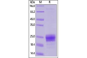 Human Flt-3 Ligand, His Tag on  under reducing (R) condition.