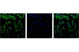 Immunofluorescence (IF) analysis of HeLa with antibody (Left) and DAPI (Right) diluted at 1:100.