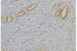ABIN6276804 at 1/100 staining Human uterus tissue by IHC-P. (TAC1 anticorps  (N-Term))