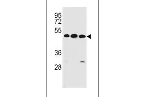 KREMEN2 Antibody (Center) (ABIN656978 and ABIN2846161) western blot analysis in ZR-75-1,K562,NCI- cell line lysates (35 μg/lane). (KREMEN2 anticorps  (AA 248-276))