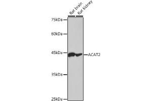 Western blot analysis of extracts of various cell lines, using  antibody (ABIN7265364) at 1:1000 dilution. (ACAT2 anticorps)