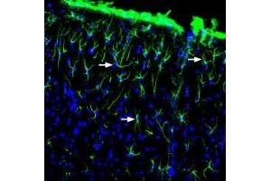 Expression of GFAP in rat brain - Immunohistochemical staining of free-floating rat frozen brain sections using Anti-GFAP Antibody (ABIN7043217, ABIN7044273 and ABIN7044274), (1:2000).