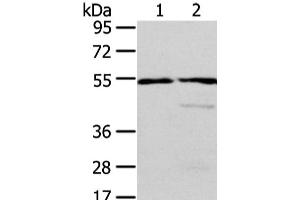 Western Blot analysis of Human normal liver and fetal liver tissue using ALDH3A2 Polyclonal Antibody at dilution of 1/250 (ALDH3A2 anticorps)