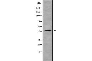 Western blot analysis OR2T4 using COLO205 whole cell lysates