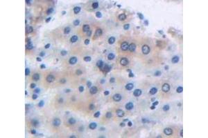 Figure. (Lectin, Galactose Binding, Soluble 5 (LGALS5) (AA 1-145) anticorps)