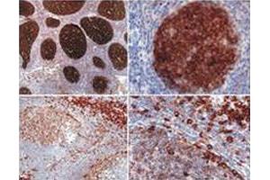 Immunohistochemistry staining (paraffin - embedded sections) using PAG1 monoclonal antibody, clone MEM - 255 . (PAG1 anticorps  (AA 97-432))