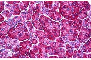 Human Pancreas: Formalin-Fixed, Parraffin-Embedded (FFPE) (Ferredoxin Reductase anticorps)