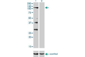 Western blot analysis of PTPRN2 over-expressed 293 cell line, cotransfected with PTPRN2 Validated Chimera RNAi (Lane 2) or non-transfected control (Lane 1). (PTPRN2 anticorps  (AA 108-212))
