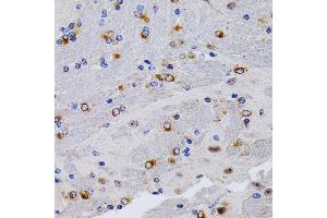 Immunohistochemistry of paraffin-embedded mouse brain using TFF1/pS2 antibody (ABIN3015565, ABIN3015566, ABIN3015567 and ABIN6218896) at dilution of 1:200 (40x lens). (TFF1 anticorps  (pSer2))