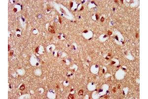 IHC image of ABIN7169728 diluted at 1:400 and staining in paraffin-embedded human brain tissue performed on a Leica BondTM system. (SIM2 anticorps  (AA 347-433))