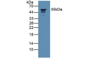 Detection of CORO1A in Human Jurkat Cells using Polyclonal Antibody to Coronin 1A (CORO1A) (Coronin 1a anticorps  (AA 7-204))