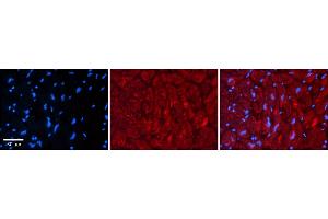 Rabbit Anti-ZFP36L1 Antibody    Formalin Fixed Paraffin Embedded Tissue: Human Adult heart  Observed Staining: Cytoplasmic Primary Antibody Concentration: 1:600 Secondary Antibody: Donkey anti-Rabbit-Cy2/3 Secondary Antibody Concentration: 1:200 Magnification: 20X Exposure Time: 0.