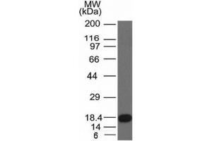Western blot of a recombinant protein fragment with c-Kit antibody (KIT/982).