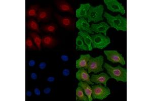 ABIN6257887 and ABIN6274270 staining Hela cells by IF/ICC. (ETV1 anticorps  (N-Term))