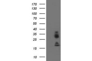 Western Blotting (WB) image for anti-Immunoglobulin J Polypeptide, Linker Protein For Immunoglobulin alpha and mu Polypeptides (IGJ) antibody (ABIN1498836) (IGJ anticorps)