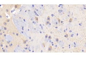 Detection of PR3 in Mouse Cerebrum Tissue using Polyclonal Antibody to Proteinase 3 (PR3) (PRTN3 anticorps  (AA 24-249))