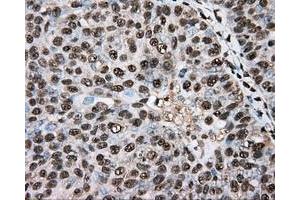 Immunohistochemical staining of paraffin-embedded colon tissue using anti-BSG mouse monoclonal antibody. (CD147 anticorps)