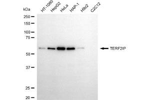 Western blotting analysis using TERF2IP antibody (ABIN7800530).