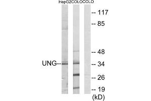 Western blot analysis of extracts from HepG2 cells and COLO cells, using UNG antibody. (UNG anticorps  (Internal Region))