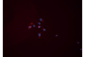 ABIN6276446 staining HEPG2 cells by ICC/IF. (Hexokinase 2 anticorps  (C-Term))