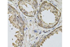 Immunohistochemistry of paraffin-embedded Human prostate using Cyclin A2 Polyclonal Antibody at dilution of 1:100 (40x lens). (Cyclin A anticorps)