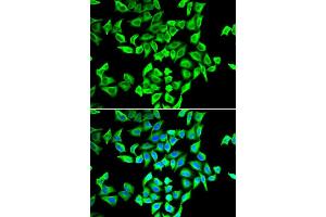 Immunofluorescence analysis of A549 cells using TP53 antibody. (p53 anticorps  (AA 1-110))