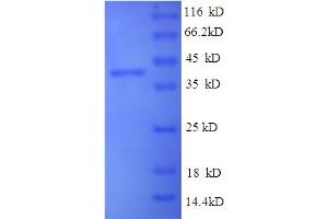 SDS-PAGE (SDS) image for Indolethylamine N-Methyltransferase (INMT) (AA 1-263), (full length) protein (His-SUMO Tag) (ABIN5709763) (INMT Protein (AA 1-263, full length) (His-SUMO Tag))