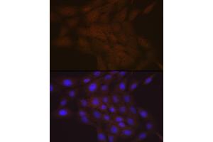 Immunofluorescence analysis of C6 cells using SMC4 Rabbit mAb (ABIN7270618) at dilution of 1:100 (40x lens).
