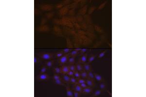 Immunofluorescence analysis of C6 cells using SMC4 Rabbit mAb (ABIN7270618) at dilution of 1:100 (40x lens). (SMC4 anticorps)
