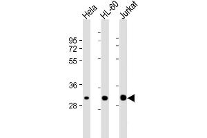 Lane 1: HeLa, Lane 2: HL-60, Lane 3: Jurkat cell lysate (20µg) probed with bsm-51309M CDK2 (1534CT665. (CDK2 anticorps)