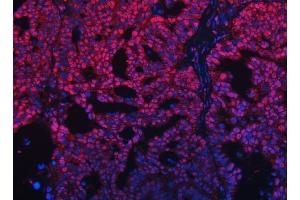 IF analysis of TRMT10C using anti-TRMT10C antibody (ABIN7601472).