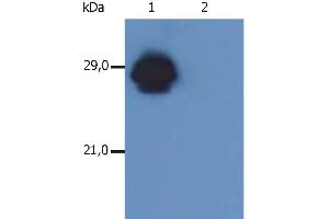 Western Blotting analysis of MHC Class II in whole cell lysate of RAJI human Burkitt lymphoma cell line using anti-human HLA-DR+DP (MEM-136). (HLA-DP/DR anticorps  (Biotin))
