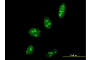 Immunofluorescence of monoclonal antibody to PELP1 on HeLa cell. (PELP1 anticorps  (AA 337-410))