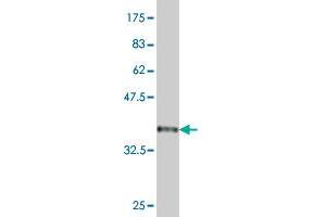 Western Blot detection against Immunogen (36. (BTG2 anticorps  (AA 59-158))