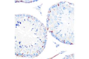 Immunohistochemistry of paraffin-embedded mouse testis using γ-Catenin Rabbit mAb (ABIN1683043, ABIN3018625, ABIN3018626 and ABIN7101634) at dilution of 1:100 (40x lens).