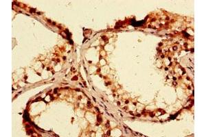 Immunohistochemistry of paraffin-embedded human testis tissue using ABIN7144930 at dilution of 1:100