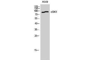Western Blotting (WB) image for anti-Protein Kinase, CGMP-Dependent, Type II (PRKG2) (Ser363), (Thr359) antibody (ABIN3174374) (PRKG2 anticorps  (Ser363, Thr359))
