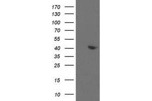 Western Blotting (WB) image for anti-Aldolase B, Fructose-Bisphosphate (ALDOB) antibody (ABIN1496605) (ALDOB anticorps)