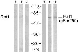 Western blot analysis of extracts using Raf-1 (Ab-259) antibody (E021006, Line 1, 2, and 3) and Raf-1 (phospho- Ser259) antibody (E011006, Line 4, 5, and 6). (RAF1 anticorps)