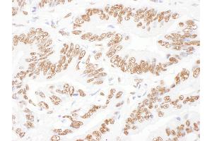 Immunohistochemistry (IHC) image for anti-Interleukin Enhancer Binding Factor 2, 45kDa (ILF2) (AA 340-390) antibody (ABIN7453441)