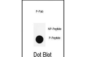 Dot blot analysis of anti-Phospho-Nanog- Antibody (ABIN390033 and ABIN2839783) on nitrocellulose membrane. (Nanog anticorps  (pSer285))