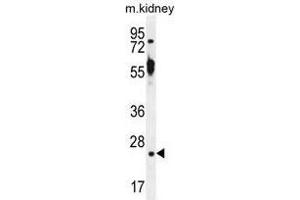 TTC9B Antibody (C-term) western blot analysis in mouse kidney tissue lysates (35 µg/lane). (TTC9B anticorps  (C-Term))