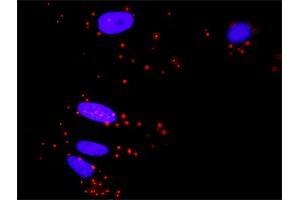 Proximity Ligation Analysis of protein-protein interactions between MAPK3 and ELK1.