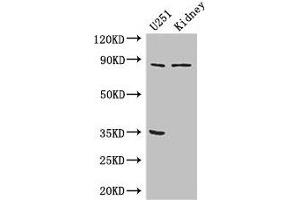 Western Blot Positive WB detected in: U251 whole cell lysate, Mouse kidney tissue All lanes: RPS6KA4 antibody at 3 μg/mL Secondary Goat polyclonal to rabbit IgG at 1/50000 dilution Predicted band size: 86, 85 kDa Observed band size: 86 kDa