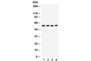 Western blot testing of 1) rat lung, 2) mouse lung, 3) human placenta, 4) Jurkat lysate with CYP1A1 antibody.