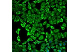Immunofluorescence analysis of HeLa cells using PSMD2 Polyclonal Antibody (PSMD2 anticorps)